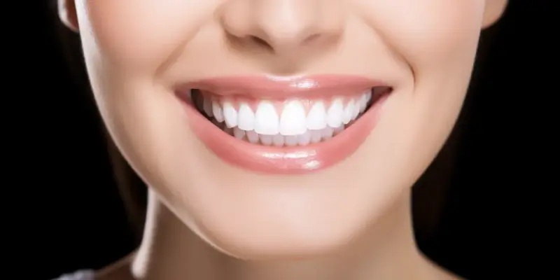 Licówki jak się robi?