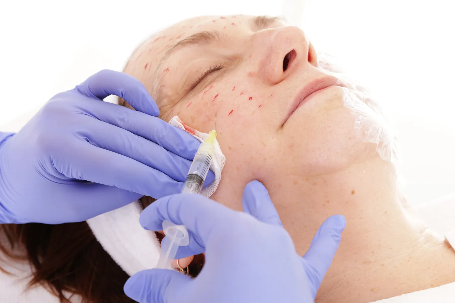 Medycyna estetyczna ile zarabia?