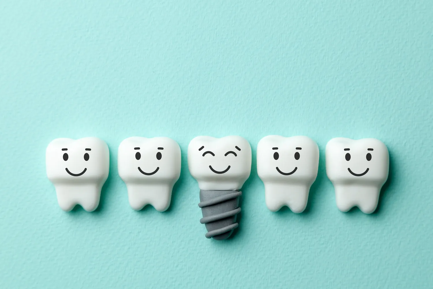 Implanty zębów cała szczęka cena Warszawa