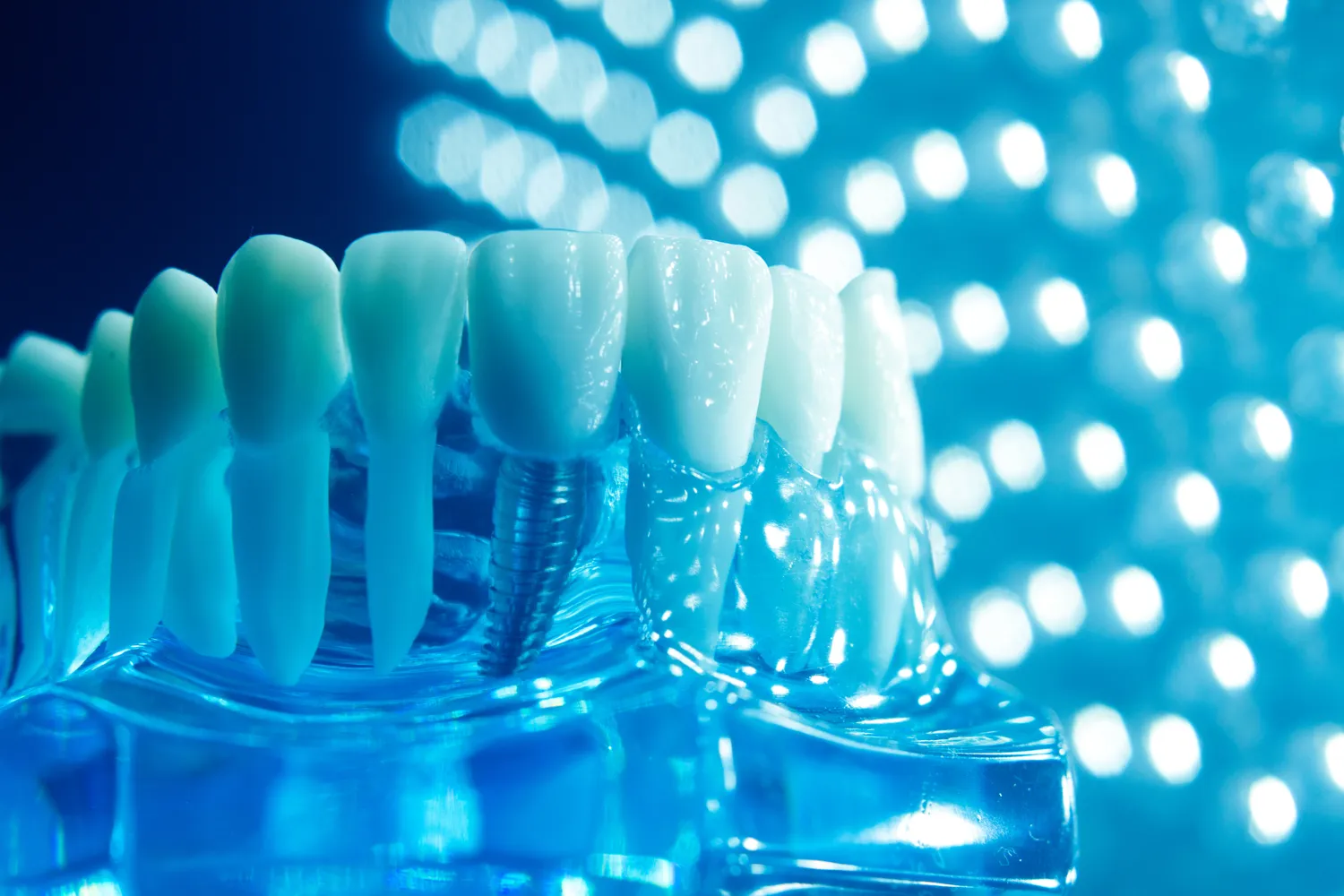 Dlaczego regularne wizyty u dentysty są tak ważne?