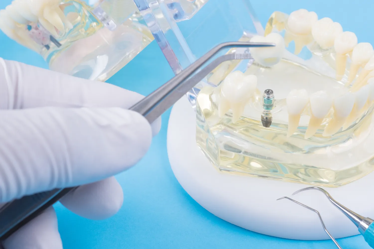 Marketing stomatologiczny