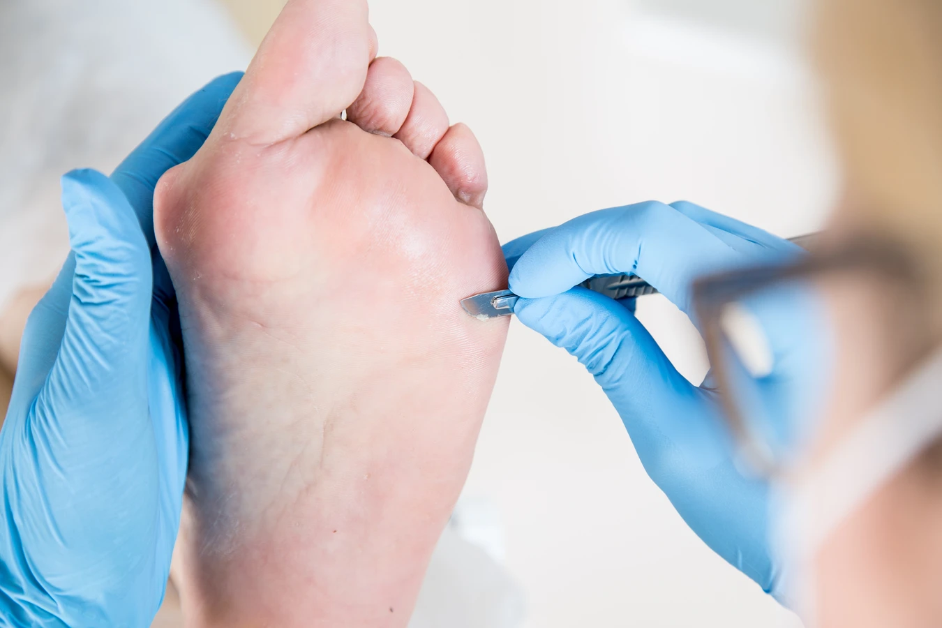  Dlaczego warto rozważyć wizytę w gabinecie podologa?